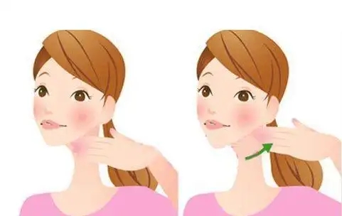 吸脂去双下巴效果(双下巴吸脂术效果)